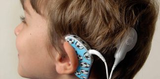 Realizohen për herë të parë implantet kokleare në QSUT