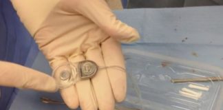 Lajmi i mirë/ Impiantet e dëgjimit do të rimbursohen nga shteti