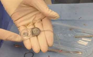 Lajmi i mirë/ Impiantet e dëgjimit do të rimbursohen nga shteti