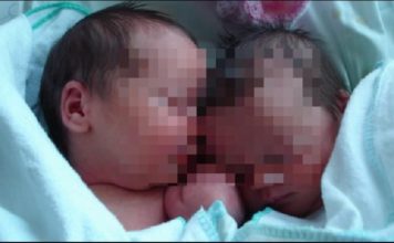 Njihuni me Andrean dhe Fabion, binjakë por të lindur në vite të ndryshme