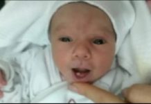 E rrallë/ Foshnja shqiptare lind me një dhëmb në gojë