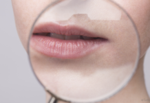 6 trajtimet natyrale për herpesat e brendshëm