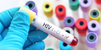 Shpresë për pacientët me HIV, kurohet plotësisht një i infektuar