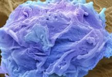 Lajmi i mirë/ Revolucion në shkencë, zbulohet substanca që vret qelizat e kancerit