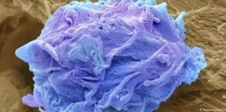 Lajmi i mirë/ Revolucion në shkencë, zbulohet substanca që vret qelizat e kancerit