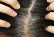 Si të shmangni thinjat e parakohshme, zbuloni disa sekrete