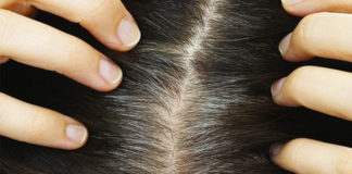 Si të shmangni thinjat e parakohshme, zbuloni disa sekrete