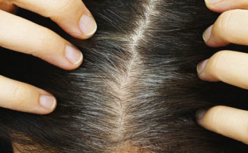 Si të shmangni thinjat e parakohshme, zbuloni disa sekrete