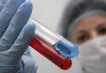 Nis testi përfundimtar për vaksinën që parandalon SIDA-n