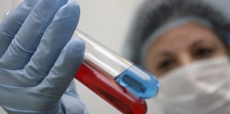 Nis testi përfundimtar për vaksinën që parandalon SIDA-n