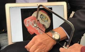 Grafitë mjekësore tani bëhen 3D dhe me ngjyra