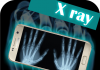 Revolucion në shkencë, shpiket fotokamera me rreze x