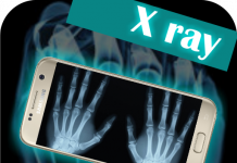 Revolucion në shkencë, shpiket fotokamera me rreze x