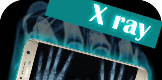 Revolucion në shkencë, shpiket fotokamera me rreze x