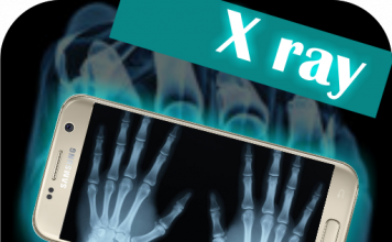 Revolucion në shkencë, shpiket fotokamera me rreze x