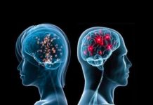 Cila është mbrojtja më e mirë për trurin dhe cilësinë e jetës