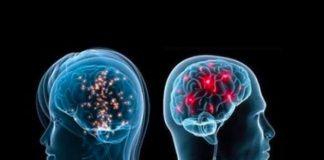 Cila është mbrojtja më e mirë për trurin dhe cilësinë e jetës