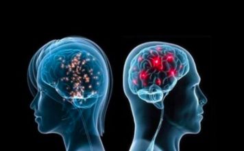 Cila është mbrojtja më e mirë për trurin dhe cilësinë e jetës