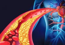 Gjashtë këshilla si të ulni tensionin e lartë të gjakut në dimër