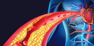 Si të pastroni enët e gjakut me një trajtim të thjeshtë natyral