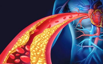 Gjashtë këshilla si të ulni tensionin e lartë të gjakut në dimër