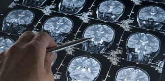 Studimi/ A e dini se në çfarë moshe truri arrin nivelin më të lartë të performancës