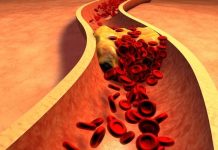 Kura natyrale që mund të aplikoni për uljen e nivelit të yndyrnave në gjak