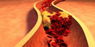 Kura natyrale që mund të aplikoni për uljen e nivelit të yndyrnave në gjak