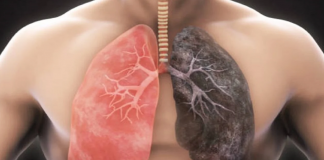 Këshilla/ Si të pastroni mushkëritë në mënyrë natyrale