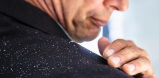 Zbokth apo Psoriazë – Përse Skalpi i Kokës Është Gjithmonë i Irrituar