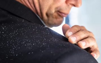 Zbokth apo Psoriazë – Përse Skalpi i Kokës Është Gjithmonë i Irrituar