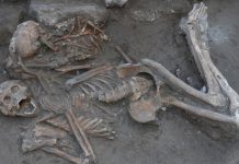 Operacioni në tru i realizuar më shumë se 3000 vjet më parë