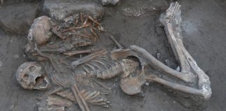 Operacioni në tru i realizuar më shumë se 3000 vjet më parë