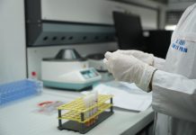 Vaksinim falas ndaj gripit stinor për 260 mijë qytetarë, 600 mijë doza vaksinash për COVID-19