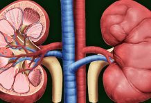 8 Ushqimet që Dëmtojnë Veshkat dhe që Duhet t’i Shmangni