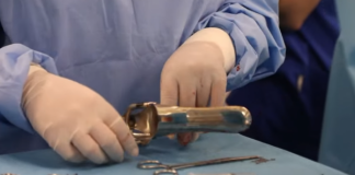 Ndërhyrja kirurgjikale me rrugë laparoskopike, risi në sistemin publik shëndetësor