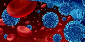 Një përzierje zëvendëson gjakun e sëmurë me gjak të shëndetshëm