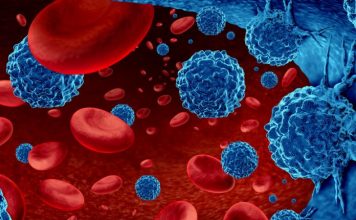 Një përzierje zëvendëson gjakun e sëmurë me gjak të shëndetshëm