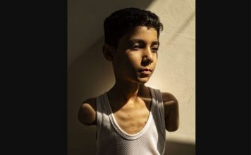 Ky imazh shpallet fotoja e vitit, ja historia e trishtë që qëndron pas!